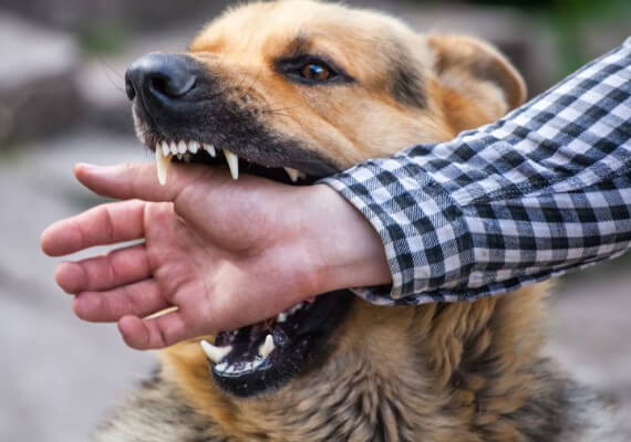 Dog Bites